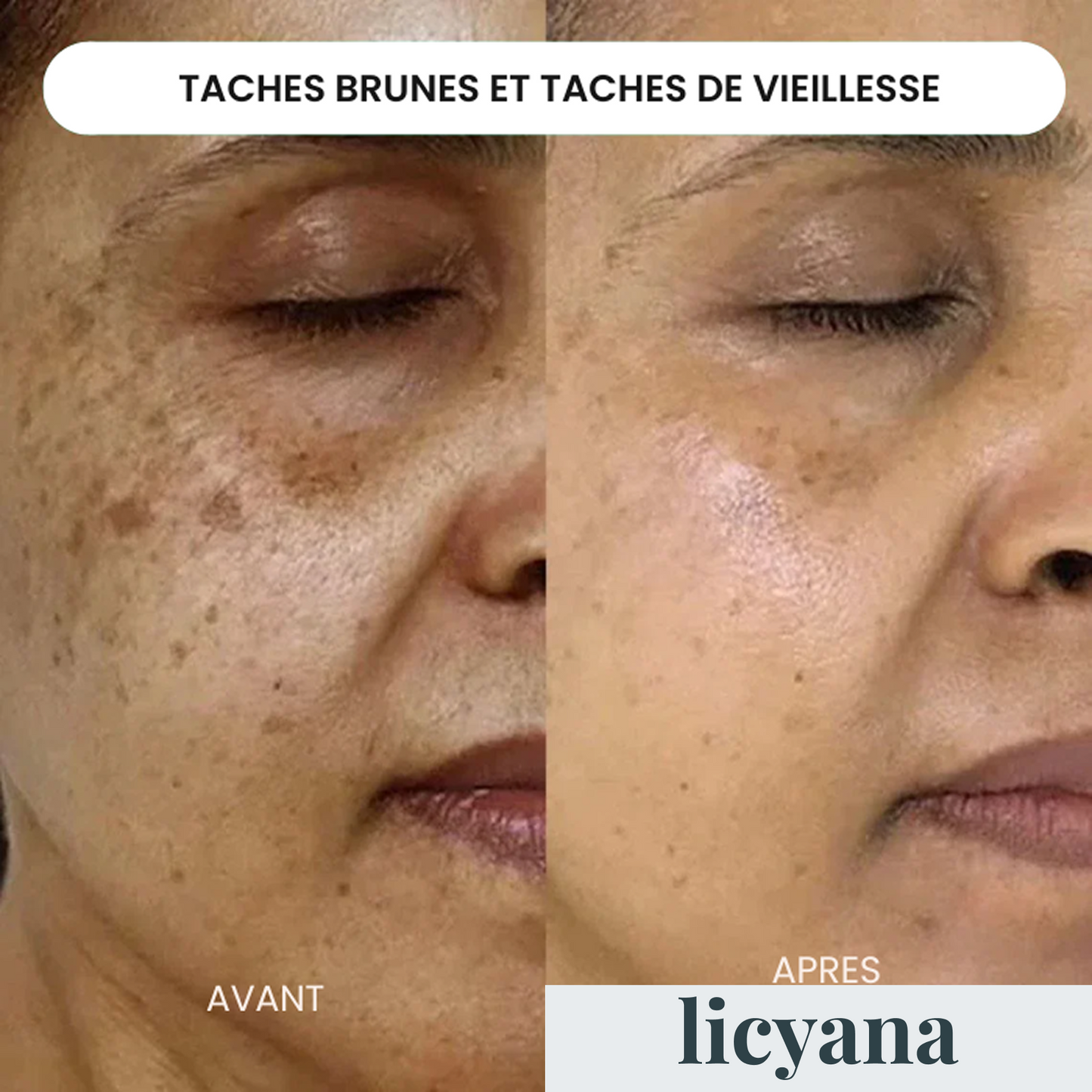 Micro Infusion Anti-âge Lift Pro™
