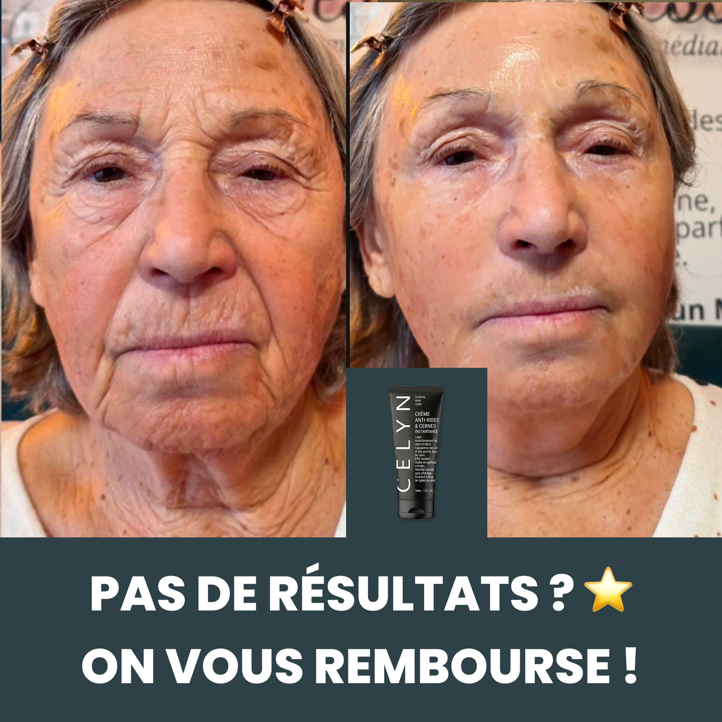 Crème Anti Cernes et Rides Instantanée