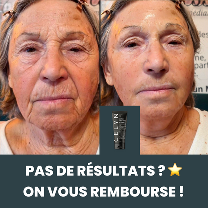 Crème Anti Cernes et Rides Instantanée