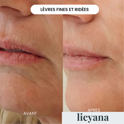 Micro Infusion Anti-âge Lift Pro™