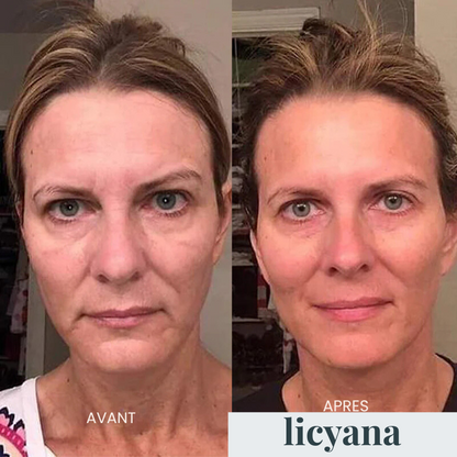 Micro Infusion Anti-âge Lift Pro™